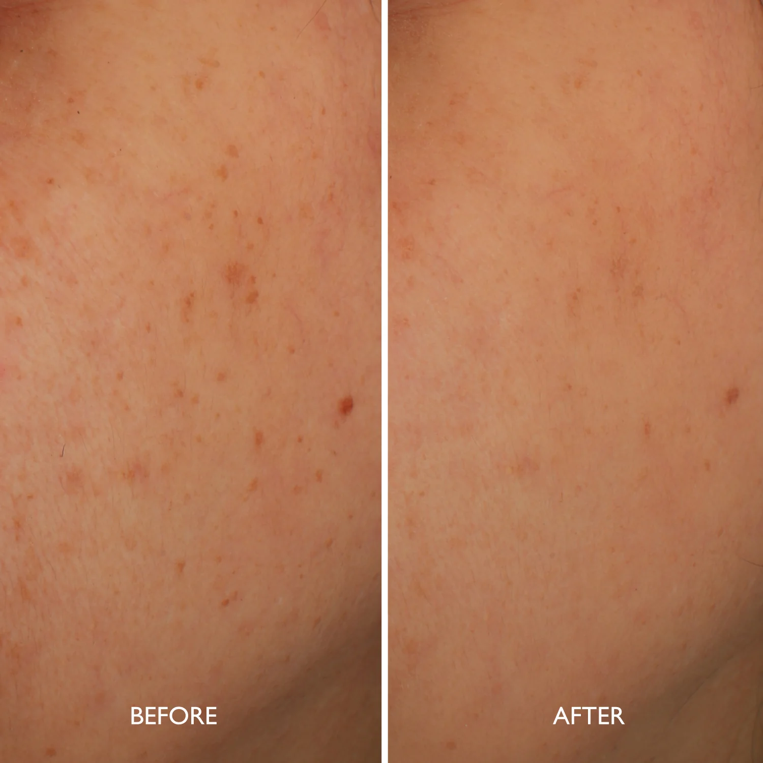 Age Benefit™ Hyperpigmentation Repair - Image 5