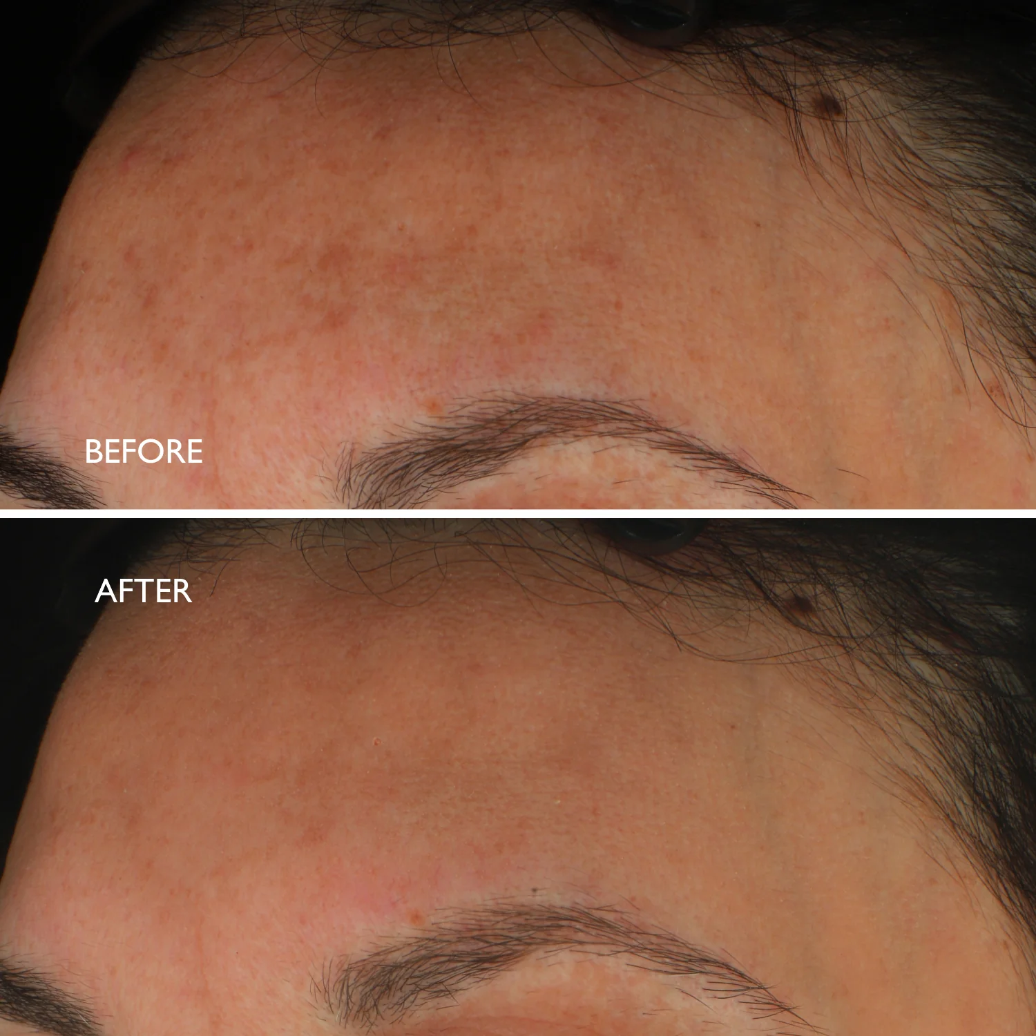 Age Benefit™ Hyperpigmentation Repair - Image 6