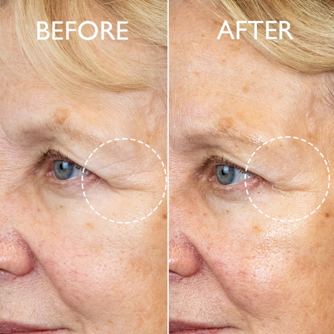 Defi Lift™ Firming Eye Contour Serum - Image 4