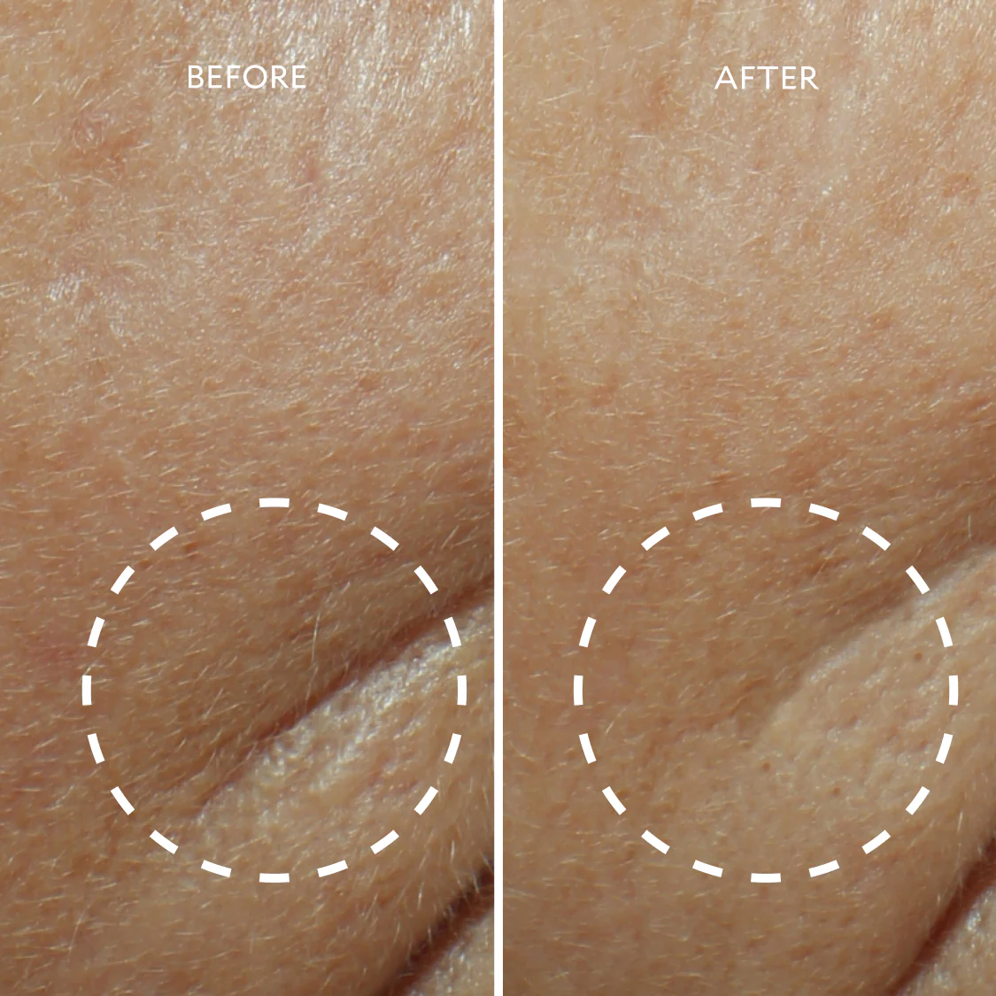 Defi Lift™ Active Firming Serum - Image 5