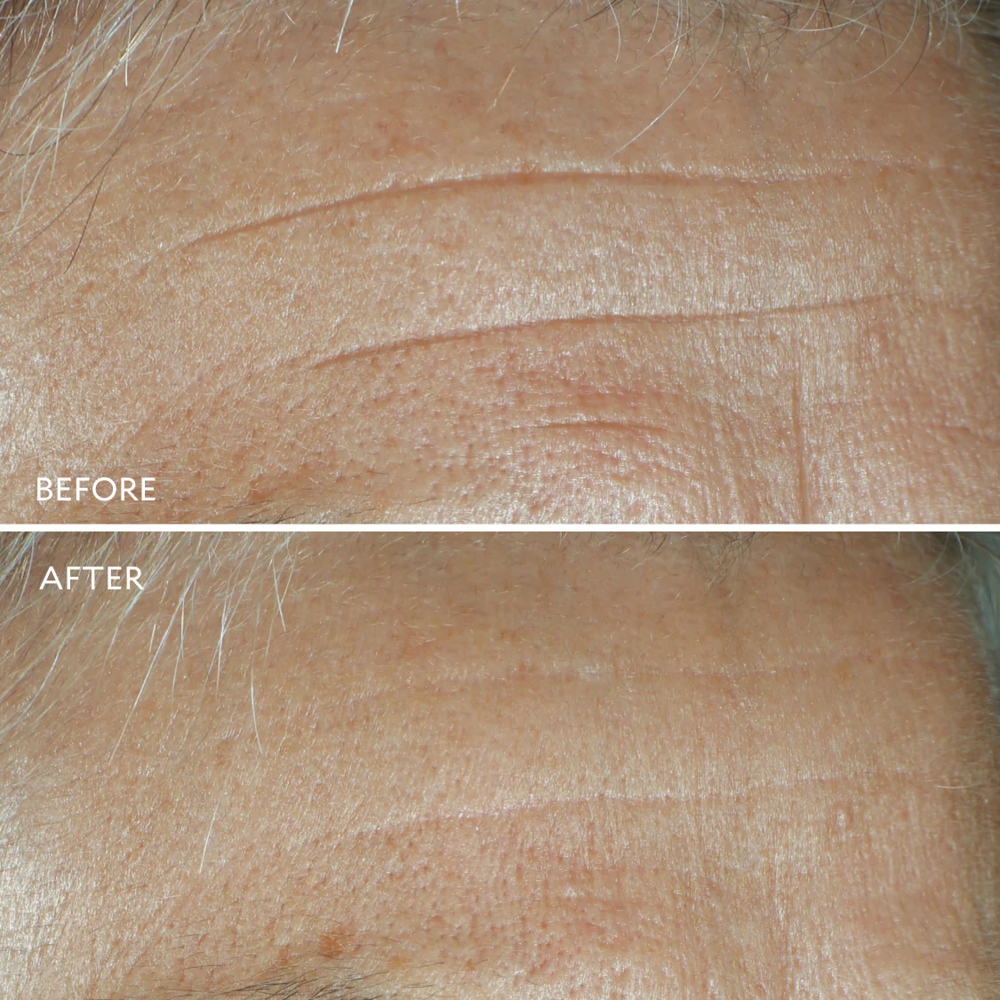 Defi Lift™ Active Firming Serum - Image 6