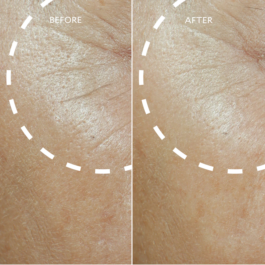 Defi Lift™ Active Firming Serum - Image 7